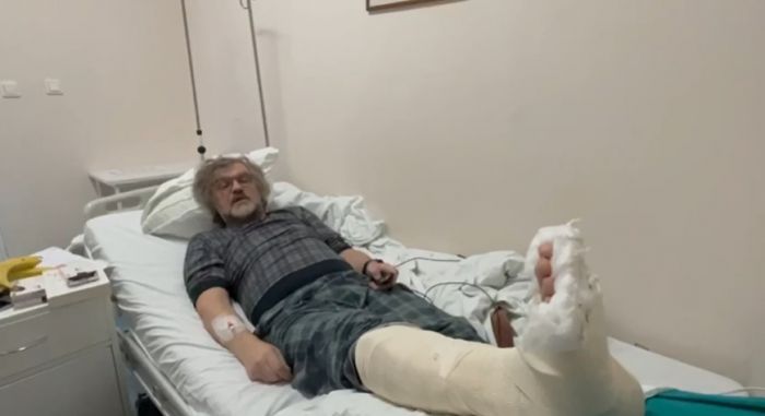 ​Эмир Кустурица не приедет на открытие «Духа огня» из-за перелома ноги