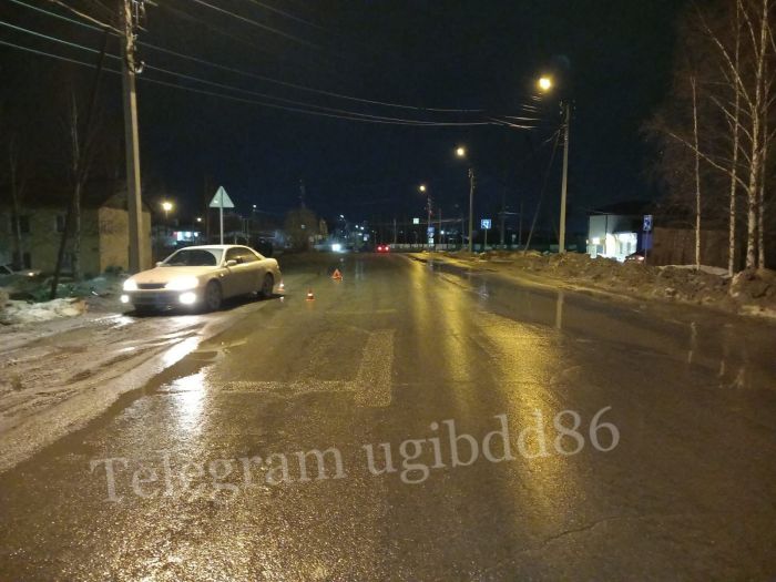 Пожилая югорчанка переходила дорогу в неположенном месте и угодила под колеса легковушки