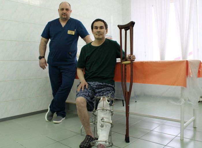 Сургутянин раздробил ногу бревном, но хирурги спасли мужчину