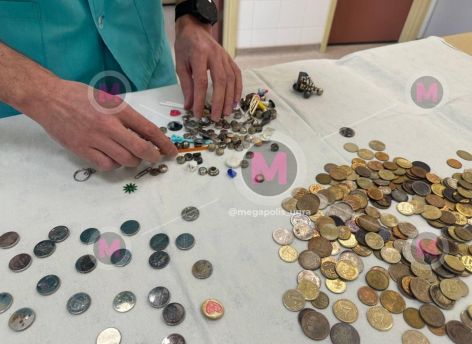 ​Нижневартовский врач показал коллекцию предметов, которые достал из детей