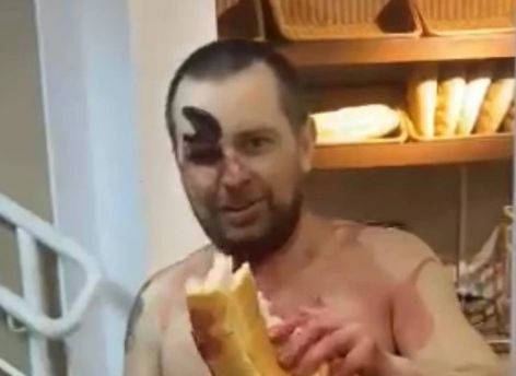 ​По улицам Нижневартовска ходил голый мужчина с ножом в глазу