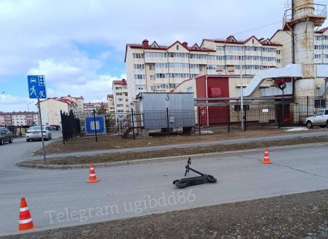 ​В Югорске женщина перевернулась на мощном электросамокате – она была без прав и отказалась от медосвидетельствования