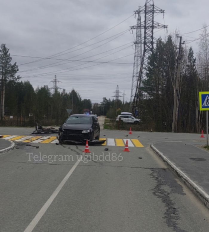 ​Два подростка пострадали в ДТП с питбайком в Сургутском районе